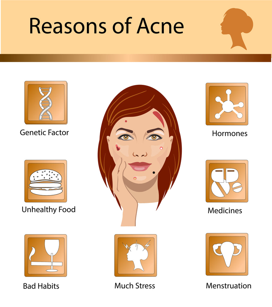 Types of Acne
